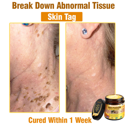 LOVILDS™ Bee Poison All-in-One Cream US Dermatologist Approved